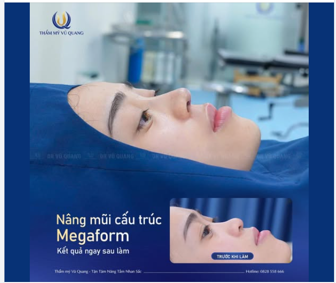 Có những lời nói tưởng chừng chỉ thoáng qua… nhưng lại trở thành nỗi tự ti đeo bám một người suốt nhiều năm.