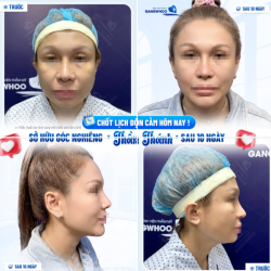 CHỐT LỊCH ĐỘN CẰM HÔM NAY