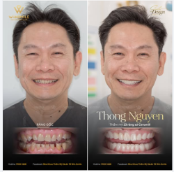“Đã rất lâu rồi mình không có nụ cười tự nhiên… Mình cứ sợ làm nó đau nhưng thực sự nó không đau…”