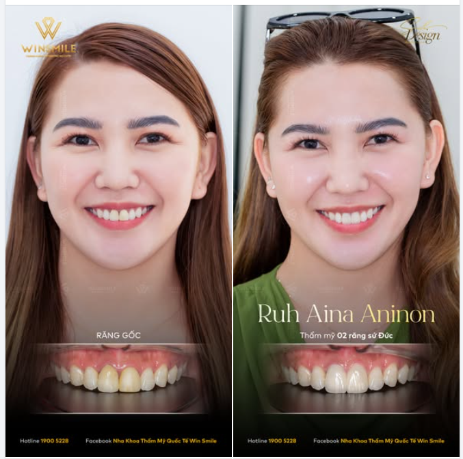KHI MỘT CHI TIẾT NHỎ NHƯNG THAY ĐỔI CẢ DIỆN MẠO