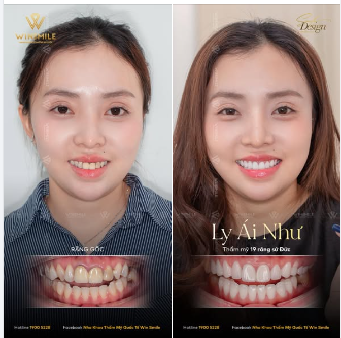 Là 1 makeup artist kiêm người có ảnh hưởng trên mạng xã hội, Ái Như là 1 cô nàng xinh đẹp, trẻ trung và đặc biệt có gu thẩm mỹ rất riêng.
