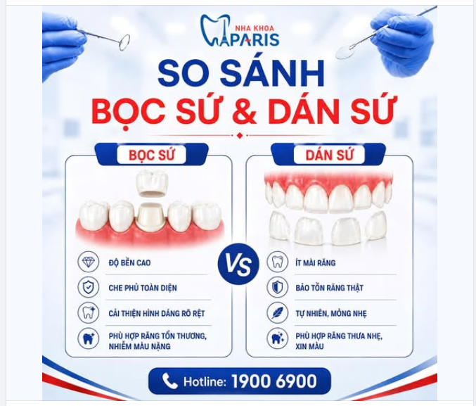 BỌC SỨ HAY DÁN SỨ – ĐÂU MỚI LÀ LỰA CHỌN "CHÂN ÁI" CỦA BẠN?