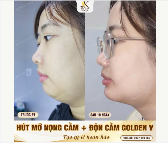 Cảm giác đẹp lên không phải là người khác khen…  Mà là chính mình thấy hài lòng mỗi khi soi gương
