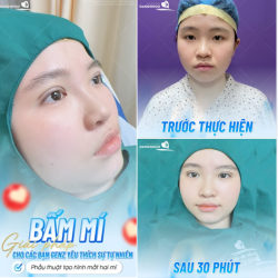 BẤM MÍ GIẢI PHÁP CHO CÁC BẠN GENZ YÊU THÍCH SỰ TỰ NHIÊN
