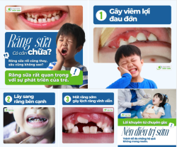 3 HỆ LUỴ CỦA SÂU RĂNG SỮA MÀ PHỤ HUYNH KHÔNG NÊN BỎ QUA