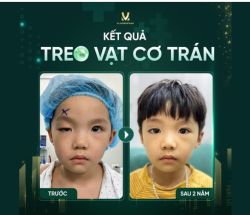 KẾT QUẢ SAU 2 NĂM – SỰ THAY ĐỔI RÕ RỆT