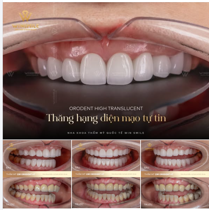 Chúng ta vẫn thường nói về việc thay đổi diện mạo để tự tin hơn, nhưng đôi khi hành trình ấy lại bắt đầu bằng việc sửa chữa những lựa chọn chưa đúng trong quá khứ.