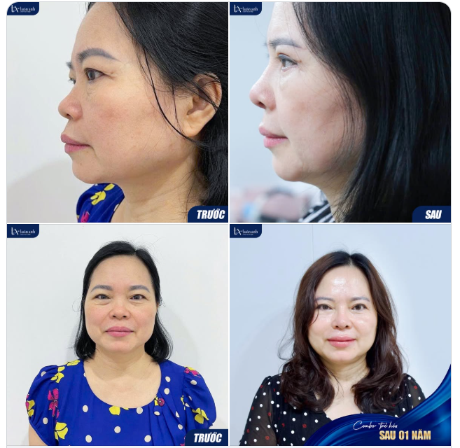 12 THÁNG – KHOẢNG THỜI GIAN ĐỦ ĐỂ NHỮNG THAY ĐỔI TRỞ NÊN TỰ NHIÊN NHẤT