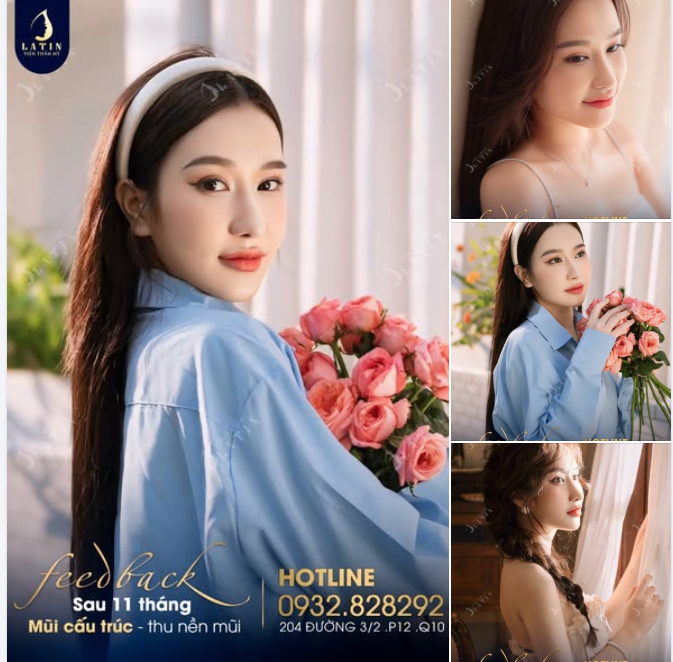 FEEDBACK MŨI CẤU TRÚC SAU 11 THÁNG  FORM CÀNG GOM CÀNG ĐẸP - CHUẨN DÁNG NÀNG THƠ