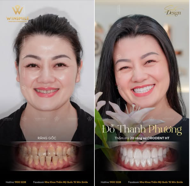 Có những nụ cười từng rất muốn được rạng rỡ, nhưng lại nhiều năm chỉ dừng ở sự dè dặt và ngập ngừng