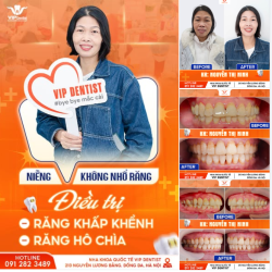 NIỀNG RĂNG U40 – KHÔNG NHỔ RĂNG – KHẮC PHỤC HÔ & KHẬP KHỂNH