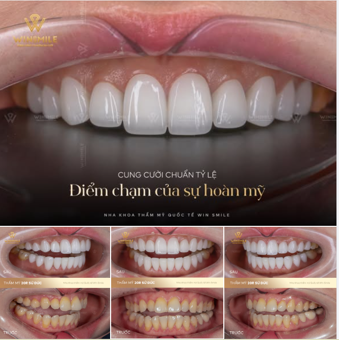 Cung cười chuẩn tỷ lệ - Điểm chạm của sự hoàn mỹ
