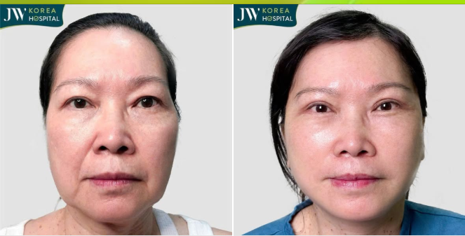 CUỘC HỘI NGỘ SAU 10 NĂM CỦA QUÝ BÀ VIỆT KIỀU MỸ VÀ HÀNH TRÌNH TRẺ 20 TUỔI TẠI JW