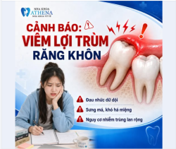 TẠM BIỆT RĂNG KHẤP KHỂNH, ĐÓN NỤ CƯỜI THẲNG TẮP CHỈ NHỜ NIỀNG RĂNG