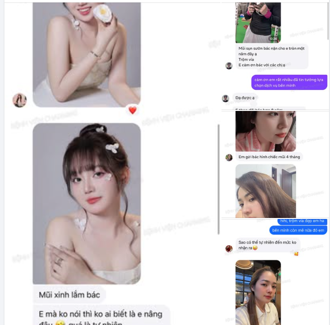 FEEDBACK KHÁCH HÀNG SAU NÂNG MŨI TẠI CHARMING