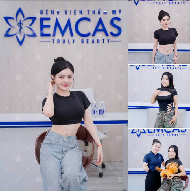 EMCAS đón hai khách hàng tái khám Tái tạo thành bụng sau 3 và 6 tháng