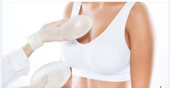 KIẾN TẠO VÒNG 1 CHUẨN TỶ LỆ