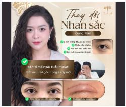 Không cần đôi mắt quá sắc để đẹp.  Chỉ cần đúng dáng mắt phù hợp với gương mặt là thần thái đã khác hoàn toàn