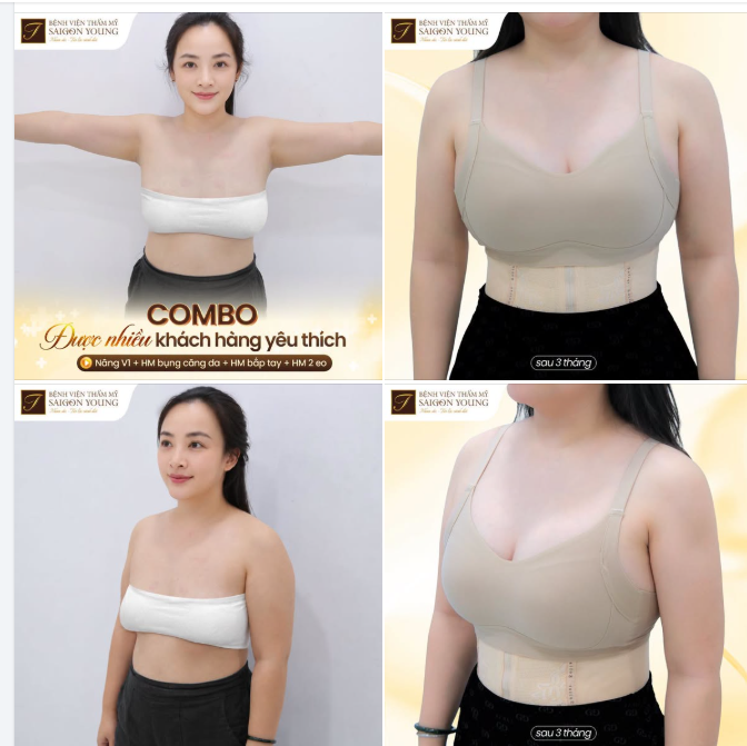 CÚ THAY ĐỔI TOÀN DIỆN - MẸ 2 CON KHIẾN CHỒNG NGỠ NGÀNG KHI GẶP LẠI