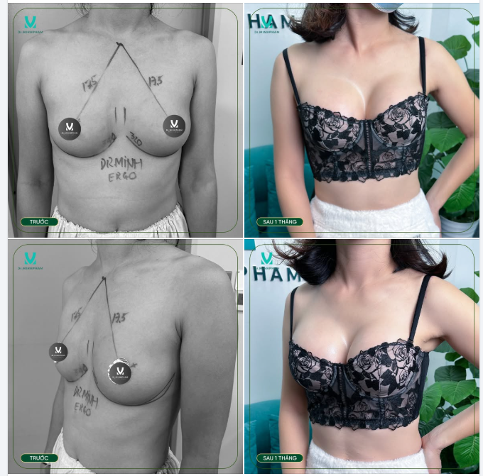 LỰA CHỌN ĐỈNH CAO – NÂNG CẤP V1 ĐÚNG GU