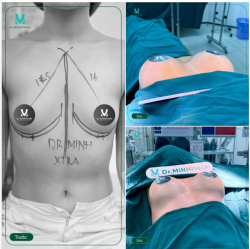 V1 CĂNG TRÒN TỰ TIN TỎA SÁNG
