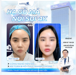 HẠ GÒ MÁ NỘI SOI 4K