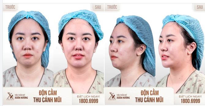 THAY ĐỔI NHỎ GIÚP KHUÔN MẶT THANH TÚ