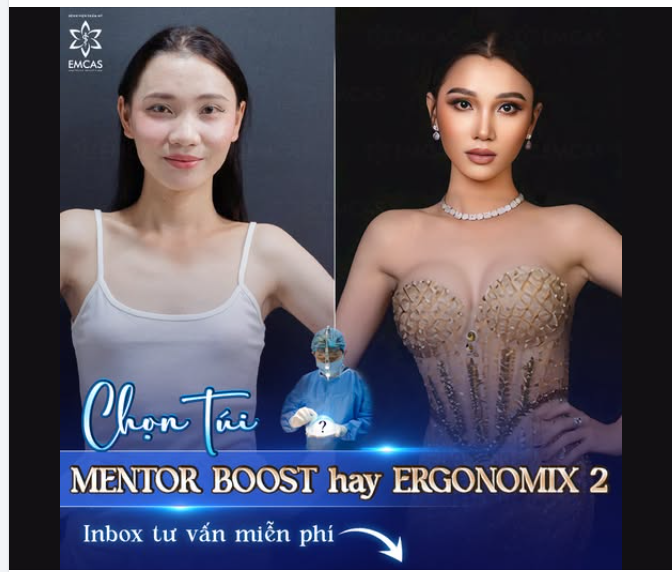 MENTOR BOOST vs ERGONOMIX 2: “KẺ TÁM LẠNG, NGƯỜI NỬA CÂN” - ĐÂU LÀ CHÂN ÁI CHO V1 CỦA CHỊ EM?