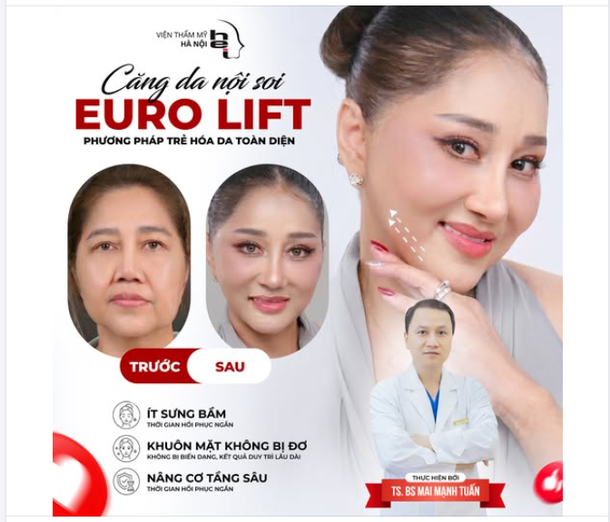CĂNG DA NỘI SOI EURO LIFT