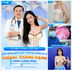 LỘ DIỆN VÒNG 1 CỰC NÉT CỦA NÀNG GENZ SAU 1 THÁNG TRÙNG TU V1 - VISUAL THĂNG HẠNG, VÒNG 1 CĂNG TRÀN “VẠN NGƯỜI MÊ”