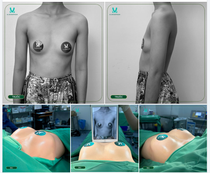 ĐẦU TUẦN KHỞI ĐỘNG BẰNG CA NÂNG CẤP V1 ĐẸP MỸ MÃN