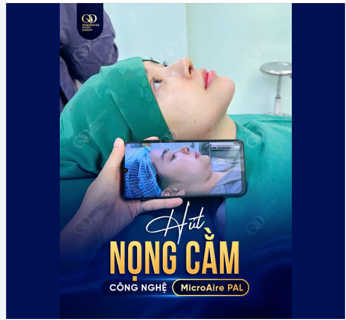CÔNG NGHỆ PAL – GIẢI PHÁP HỖ TRỢ HÚT MỠ NỌNG CẰM
