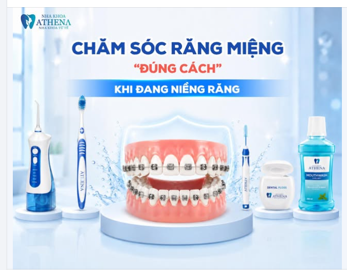 CHĂM SÓC RĂNG MIỆNG ĐÚNG CÁCH KHI ĐANG NIỀNG RĂNG