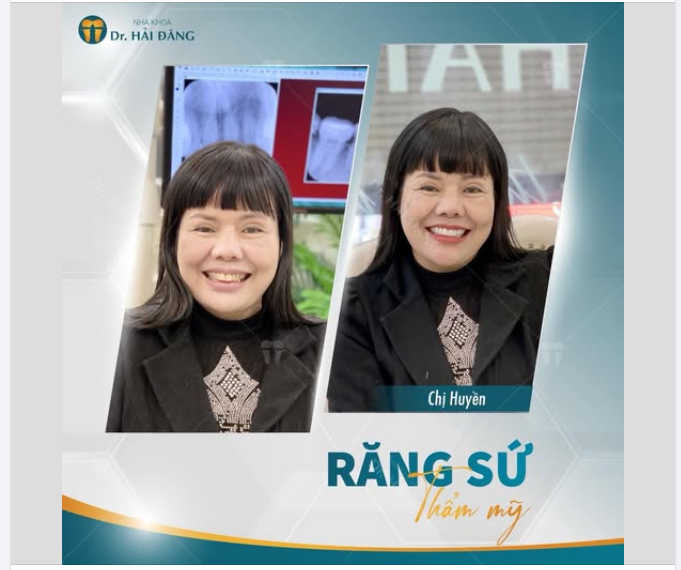 NỤ CƯỜI THAY ĐỔI – DIỆN MẠO RẠNG NGỜI