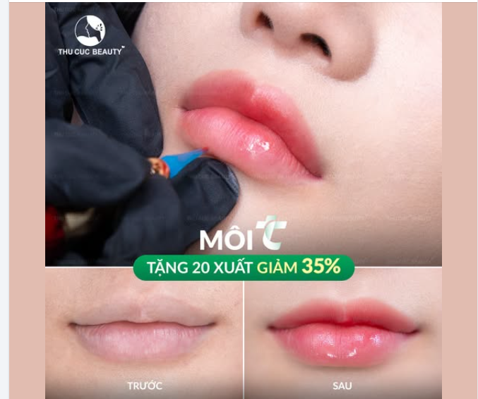DEAL CHẤN ĐỘNG: TẶNG 20 SUẤT GIẢM 35% MÔI TC!