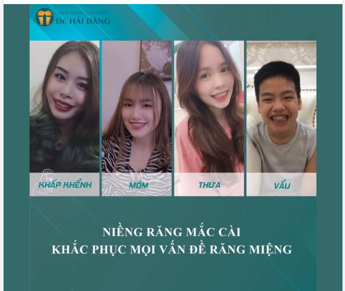 NIỀNG RĂNG MẮC CÀI – GIẢI PHÁP KHẮC PHỤC HIỆU QUẢ CÁC TÌNH TRẠNG RĂNG KHẤP KHỂNH - MÓM - THƯA - VẨU
