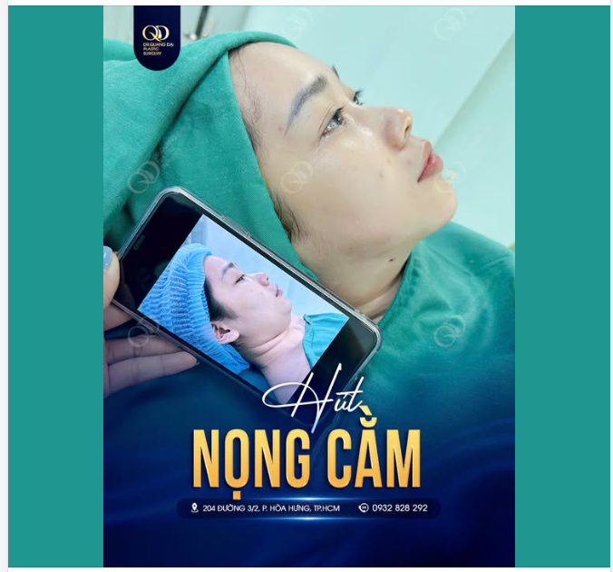 CẰM THON — MẶT GỌN — TỰ TIN NHÂN ĐÔI!