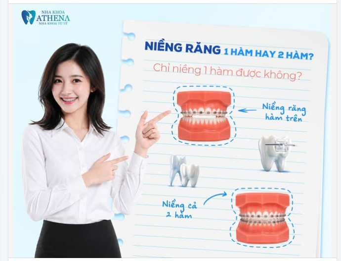 NIỀNG RĂNG 1 HÀM HAY 2 HÀM? CHỈ NIỀNG 1 HÀM CÓ ĐƯỢC KHÔNG?