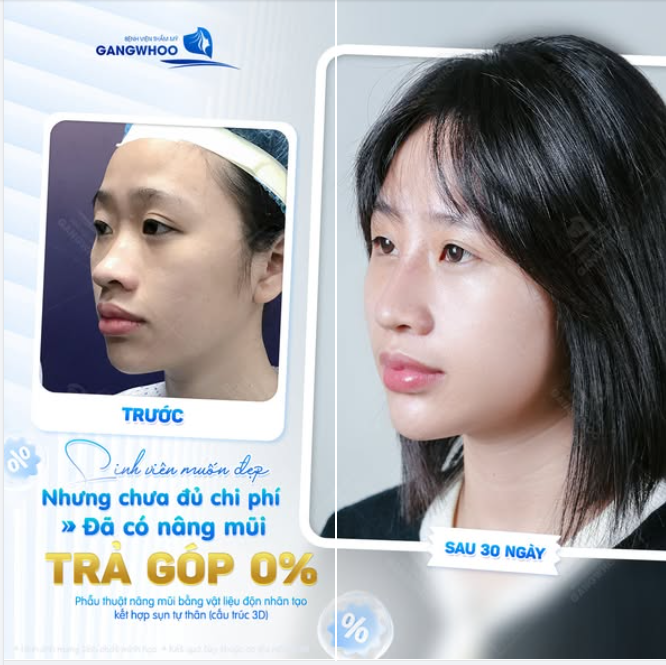 SINH VIÊN MUỐN ĐẸP NHƯNG CHƯA ĐỦ CHI PHÍ