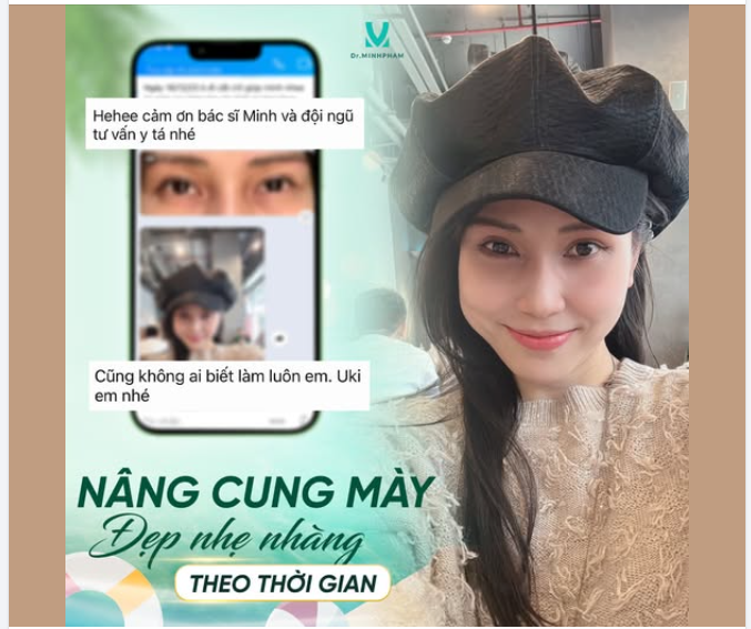 FEEDBACK THỰC TẾ SAU TREO CUNG MÀY TẠI DR. MINH PHẠM