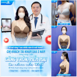 AI NÓI VÒNG 1 SAU NHIỀU NĂM LÀ MẤT FORM? CHỊ KHÁCH TÁI KHÁM SAU 3 NĂM, DÁNG VÒNG 1 VẪN CĂNG TRÒN, MỀM MẠI TỰ NHIÊN NHƯ THẬT