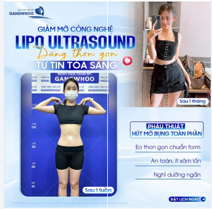 ĐỊNH HÌNH DÁNG THON GỌN – TỰ TIN TỎA SÁNG VỚI DIỆN MẠO MỚI