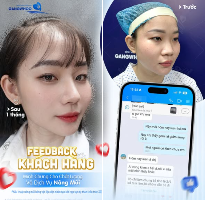 FEEDBACK KHÁCH HÀNG NÂNG MŨI