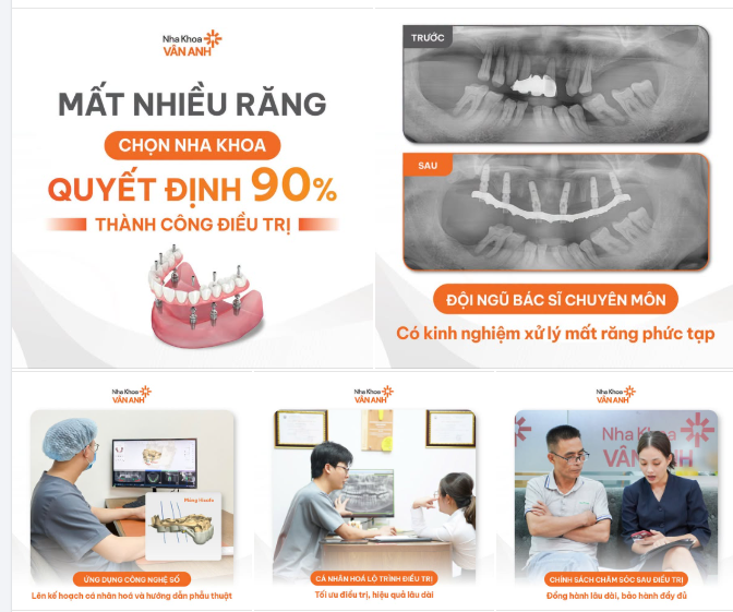 CÔ CHÚ MẤT NHIỀU RĂNG TIẾT KIỆM CHI PHÍ NHỜ CHỌN ĐÚNG NHA KHOA ĐIỀU TRỊ