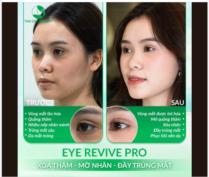 Thức đêm cày phim, làm việc máy tính liên tục khiến đôi mắt ngày càng thâm quầng, bọng mắt trũng sâu, khiến bạn trông luôn mệt mỏi và già trước tuổi.
