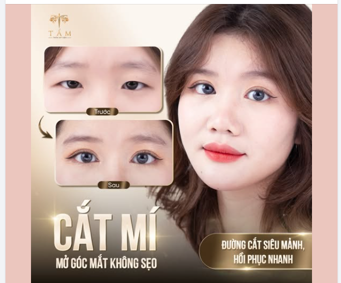 MÍ MỚI LONG LANH – TỰ TIN TỎA SÁNG