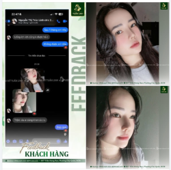 FEEDBACK KHÁCH HÀNG SAU NÂNG MŨI