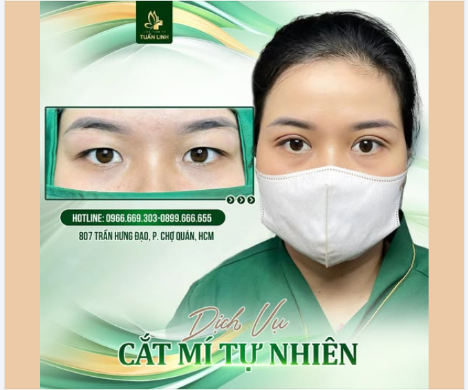 CẮT MÍ – NHỎ THÔI NHƯNG THAY ĐỔI CẢ THẦN THÁI GƯƠNG MẶT