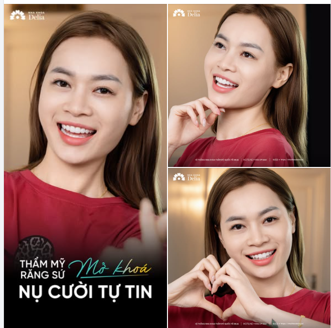 MỞ KHÓA NỤ CƯỜI TỰ TIN VỚI THẨM MỸ 18 RĂNG SỨ LAVA PLUS