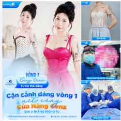 VÒNG 1 CĂNG TRÀN, TỰ TIN THẢ DÁNG - CẬN CẢNH DÁNG VÒNG 1 NÉT CĂNG CỦA NÀNG GENZ SAU 3 THÁNG TRÙNG TU